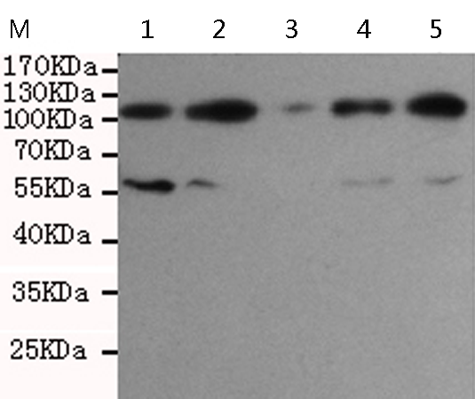 小鼠抗SIRT1单克隆抗体
