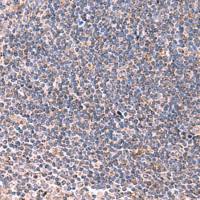 兔抗LIPA多克隆抗体