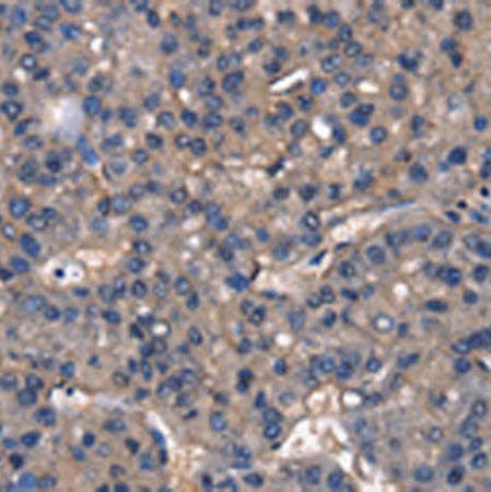 兔抗IGFBP5多克隆抗体