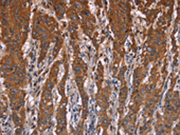 兔抗LAMP2多克隆抗体