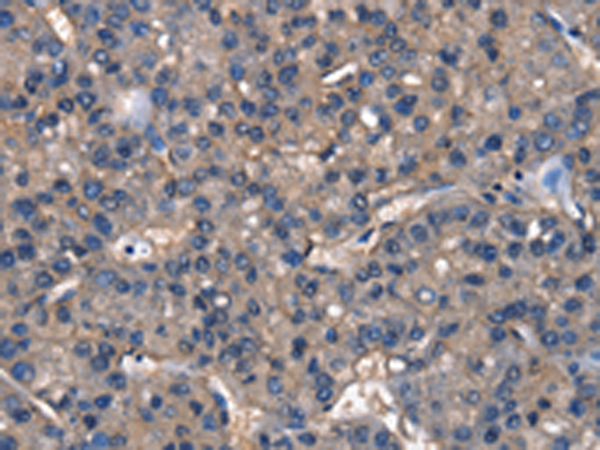 兔抗IGFBP5多克隆抗体