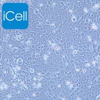 HCC94、HCC94细胞、HCC-94细胞、HCC-94、人子宫鳞癌细胞(高分化) /STR鉴定/镜像绮点（Cellverse）