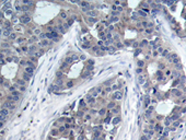 兔抗IRS1(Phospho-Ser636)多克隆抗体