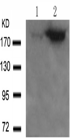 兔抗IRS1(Phospho-Ser636)多克隆抗体