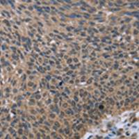 兔抗IMPDH2多克隆抗体