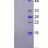 猫眼综合征染色体区候选基因1(CECR1)重组蛋白(多属种)