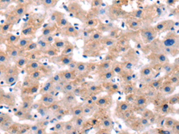 兔抗ITGA5多克隆抗体