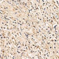 兔抗HLA-DQB1多克隆抗体