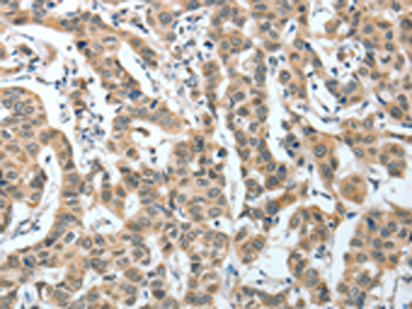 兔抗IL1R1多克隆抗体