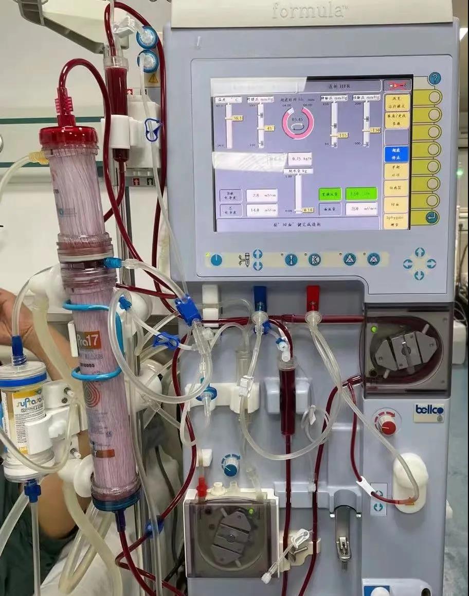 陕西首例|西安医学院一附院开展第三代血液净化新技术「血滤吸附 SupraHFR」