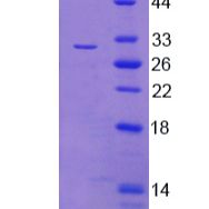 四加半LIM域蛋白1(FHL1)重组蛋白(多属种)