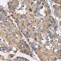 兔抗IP6K2多克隆抗体