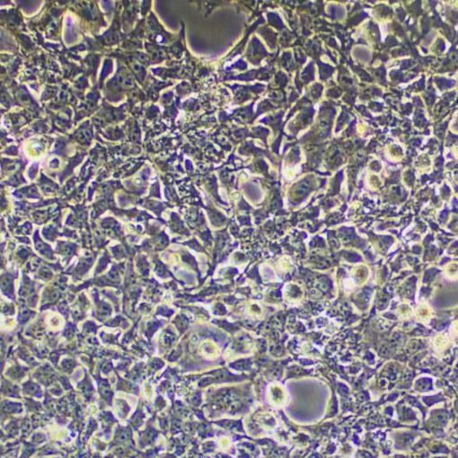 表达SV40T抗原人胚肾上皮细胞；293FT