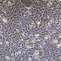 表达SV40T抗原人胚肾上皮细胞;293FT