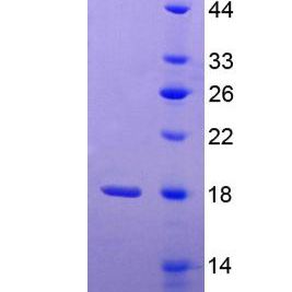 p21蛋白激活激酶1(PAK1)重组蛋白(多属种)