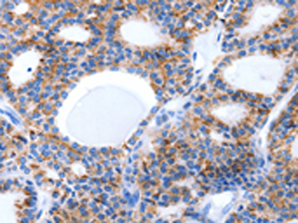 兔抗LAMA5多克隆抗体