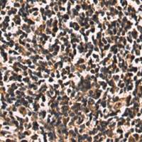 兔抗IL9多克隆抗体