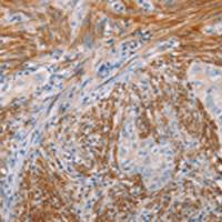 兔抗KLK4多克隆抗体