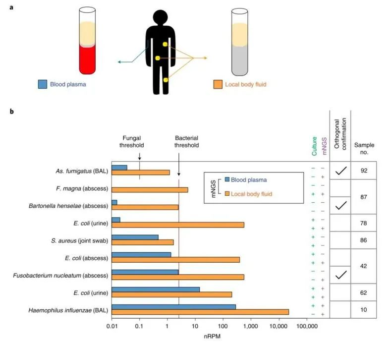 Nature Medicine : 利用宏基因组测序技术快速检测人类体液样本中的病原体
