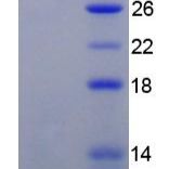 40kDa热休克蛋白2(HSPF2)重组蛋白(多属种)
