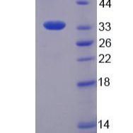 桥粒芯胶粘蛋白1(DSC1)重组蛋白(多属种)