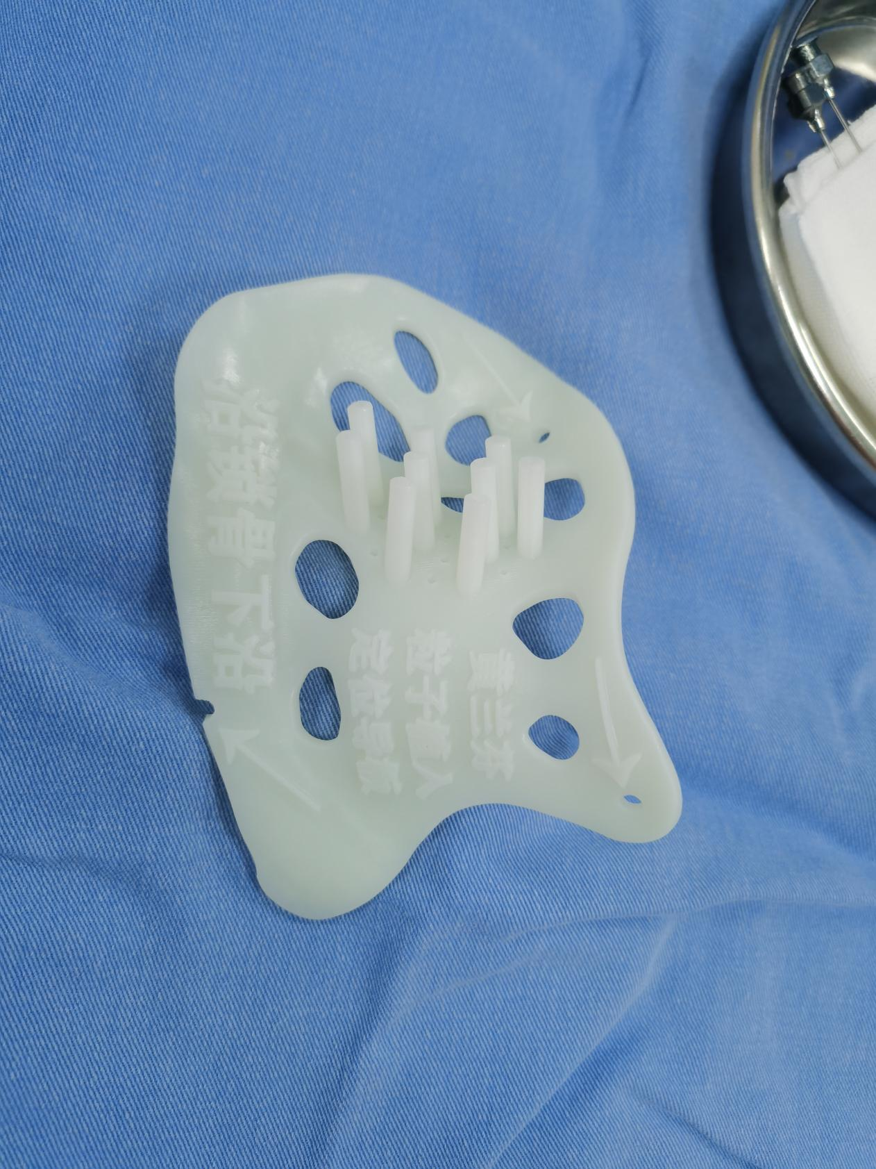 广西首例！广西壮族自治区南溪山医院运用 3D 打印技术植入放射性粒子治疗恶性肿瘤