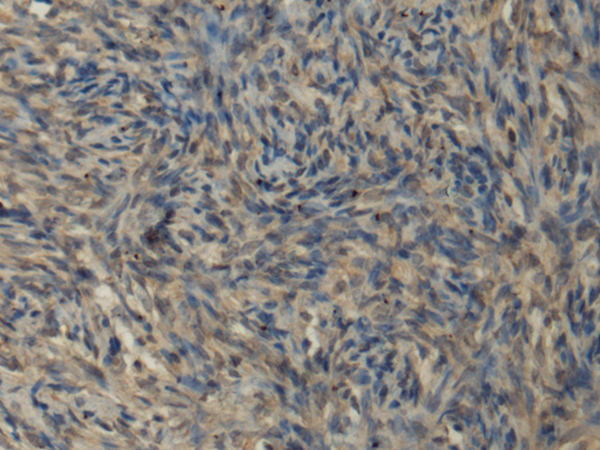 兔抗IL1RL2多克隆抗体