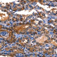 兔抗LGALS8多克隆抗体