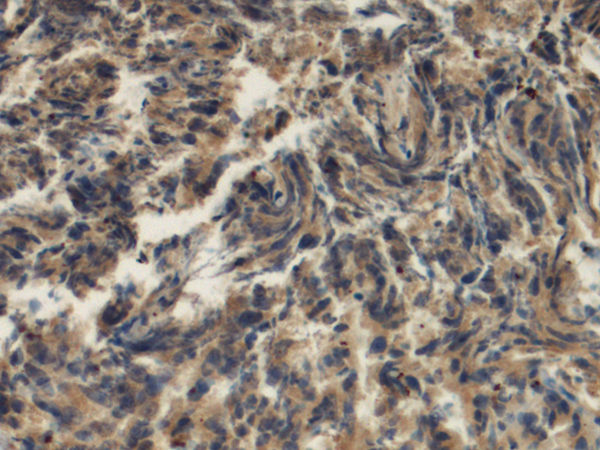 兔抗IL1RL2多克隆抗体