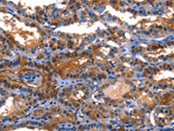 兔抗LGALS8多克隆抗体