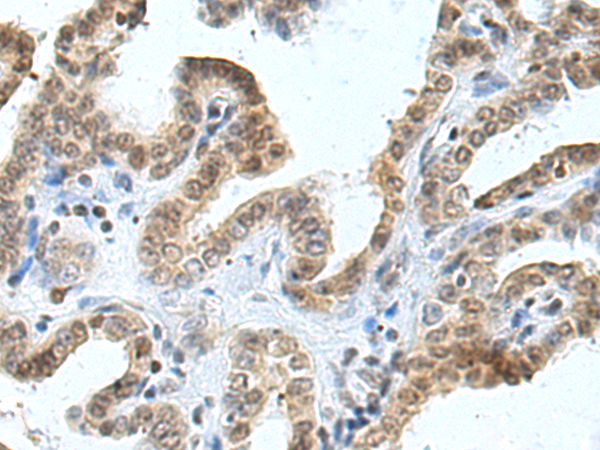 小鼠抗PARP1(Cleaved)单克隆抗体