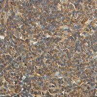 兔抗ACTB多克隆抗体