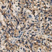 小鼠抗TUBB3单克隆抗体