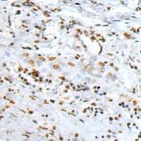 小鼠抗PARP1(Cleaved)单克隆抗体