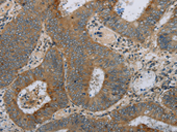 兔抗HSD17B14多克隆抗体