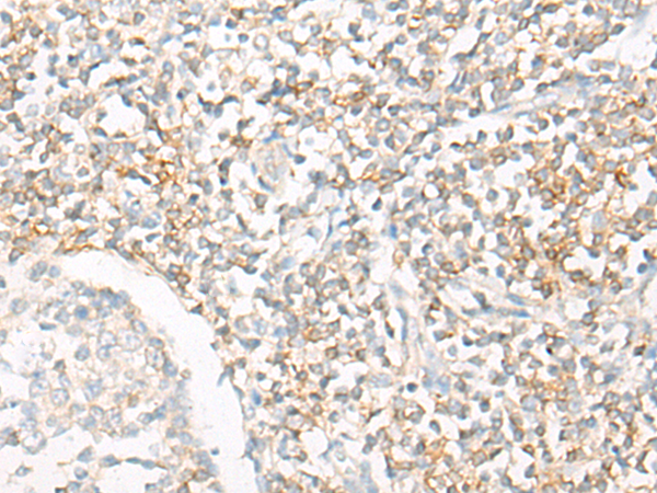 兔抗IL16多克隆抗体