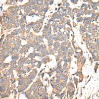 兔抗TUBA4A多克隆抗体