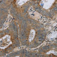 兔抗HSD17B14多克隆抗体