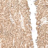 兔抗LGALS4多克隆抗体