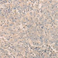 兔抗TUBB3多克隆抗体