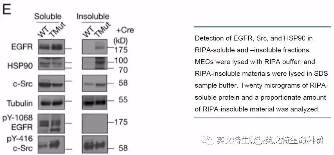 磷酸化蛋白WB有点难？第一步可能就做错了！