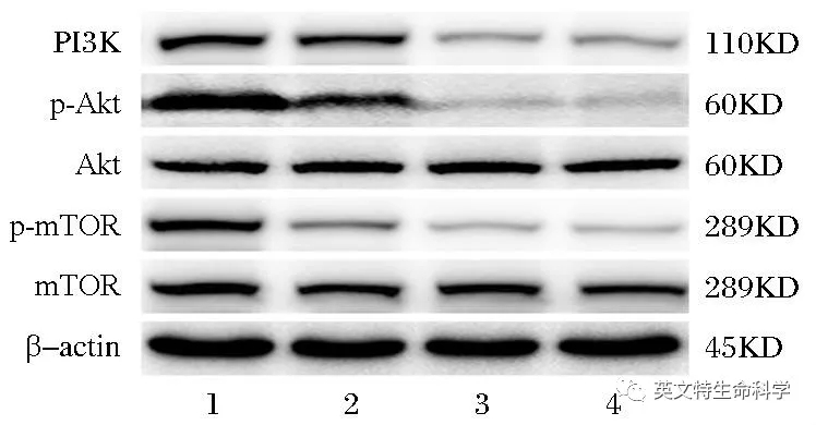 磷酸化蛋白WB有点难?第一步可能就做错了!