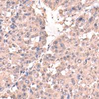 兔抗HPN多克隆抗体