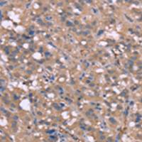 兔抗HP多克隆抗体