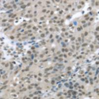 兔抗HDAC1多克隆抗体