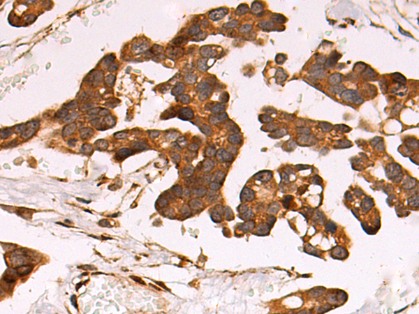 兔抗LRP1多克隆抗体