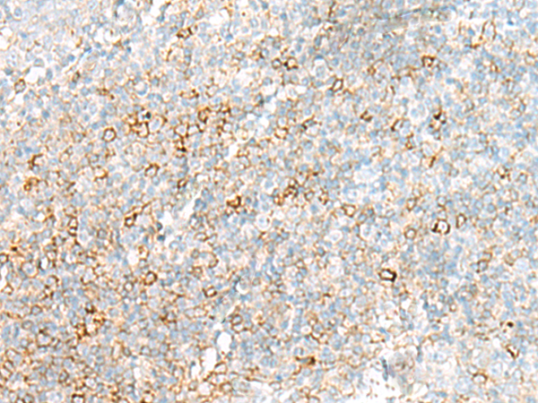 兔抗HLA-DRB3多克隆抗体