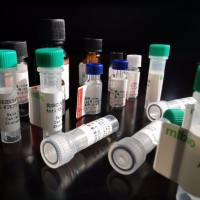 CENPU 抗原（重组蛋白）