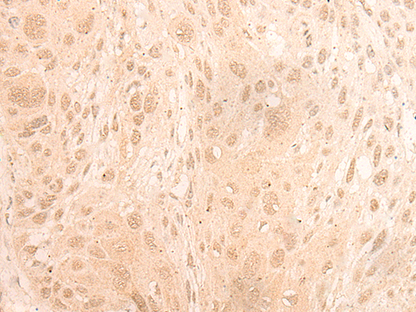 兔抗LTO1多克隆抗体