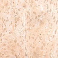 兔抗LTO1多克隆抗体